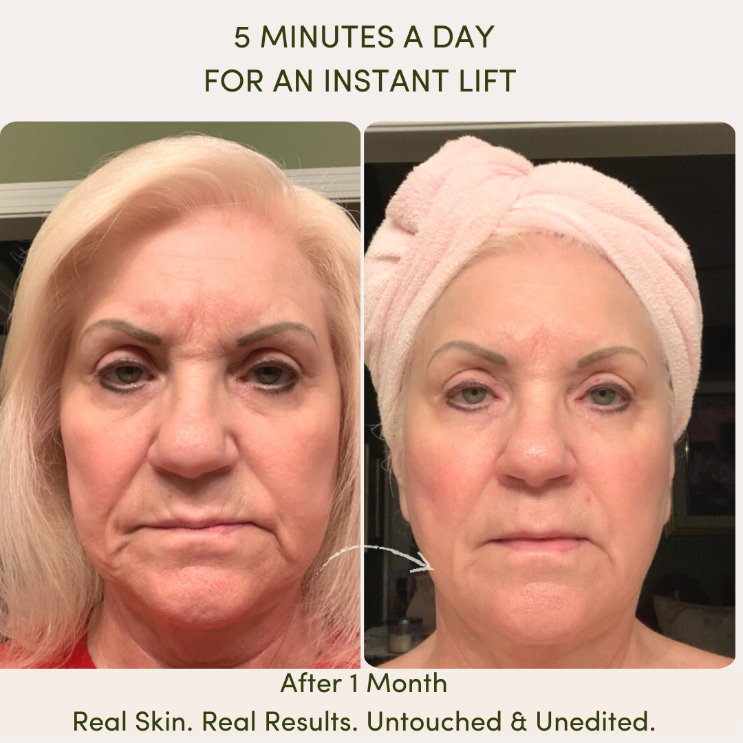 Before and after results of using Me Time Botanicals Everything Device, showing a visible instant lift, reduced fine lines, and improved facial contours after one month of use, with the tagline 'Real Skin. Real Results. Untouched & Unedited