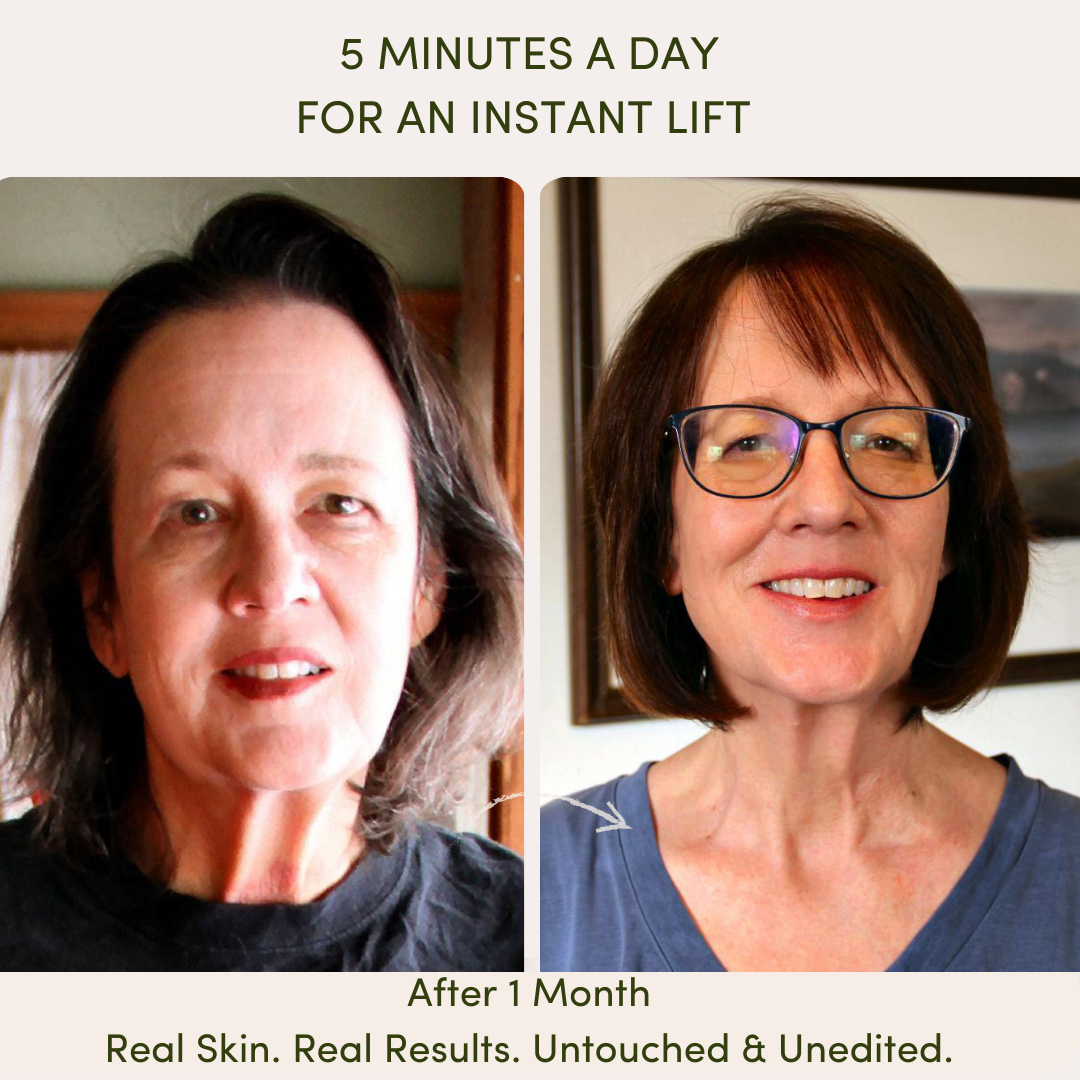 "Before and after results of using Me Time Botanicals Everything Device, showing a noticeable instant lift, reduced sagging, and rejuvenated skin tone after one month of use, with the tagline 'Real Skin. Real Results. Untouched & Unedited